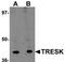 Potassium Two Pore Domain Channel Subfamily K Member 18 antibody, TA306901, Origene, Western Blot image 