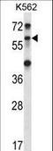 TRIM27 antibody, LS-C160182, Lifespan Biosciences, Western Blot image 