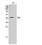 RAGE antibody, STJ95358, St John