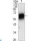 Receptor Tyrosine Kinase Like Orphan Receptor 1 antibody, LS-C813223, Lifespan Biosciences, Western Blot image 