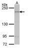 ArfGAP With RhoGAP Domain, Ankyrin Repeat And PH Domain 1 antibody, GTX106303, GeneTex, Western Blot image 