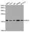 Ubiquitin Conjugating Enzyme E2 C antibody, MBS2522358, MyBioSource, Western Blot image 