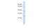 Tumor Protein D52 antibody, NBP1-56457, Novus Biologicals, Western Blot image 