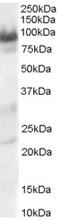 Trafficking kinesin-binding protein 1 antibody, EB06605, Everest Biotech, Western Blot image 