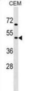 Cholinergic Receptor Nicotinic Gamma Subunit antibody, abx029286, Abbexa, Western Blot image 