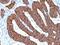 Keratin 8 antibody, 33-683, ProSci, Immunohistochemistry paraffin image 