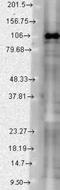 Discs Large MAGUK Scaffold Protein 3 antibody, NBP1-21672, Novus Biologicals, Western Blot image 