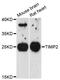 TIMP Metallopeptidase Inhibitor 2 antibody, LS-C331538, Lifespan Biosciences, Western Blot image 