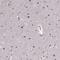 Ras Related GTP Binding D antibody, PA5-67003, Invitrogen Antibodies, Immunohistochemistry paraffin image 
