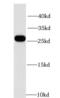 Glutathione Peroxidase 4 antibody, FNab03622, FineTest, Western Blot image 