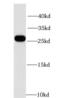 Phospholipid hydroperoxide glutathione peroxidase, mitochondrial antibody, FNab03622, FineTest, Western Blot image 