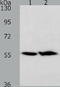 Acyl-CoA Thioesterase 2 antibody, TA322465, Origene, Western Blot image 