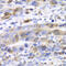 Ubiquitin Conjugating Enzyme E2 C antibody, 19-701, ProSci, Immunohistochemistry frozen image 
