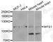 Wolframin ER Transmembrane Glycoprotein antibody, A1705, ABclonal Technology, Western Blot image 