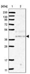 NSE4 Homolog A, SMC5-SMC6 Complex Component antibody, PA5-57954, Invitrogen Antibodies, Western Blot image 