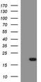 Apoptosis regulatory protein Siva antibody, TA506825, Origene, Western Blot image 