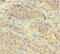PHD Finger Protein 6 antibody, A57345-100, Epigentek, Immunohistochemistry paraffin image 