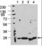 Autophagy Related 5 antibody, LS-C156610, Lifespan Biosciences, Western Blot image 