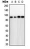 Tousled Like Kinase 1 antibody, LS-C353211, Lifespan Biosciences, Western Blot image 