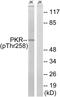Eukaryotic Translation Initiation Factor 2 Alpha Kinase 2 antibody, P30455, Boster Biological Technology, Western Blot image 