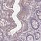 Matrix Metallopeptidase 14 antibody, NBP2-38649, Novus Biologicals, Immunohistochemistry paraffin image 