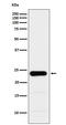 Glutathione S-Transferase Pi 1 antibody, M00394-1, Boster Biological Technology, Western Blot image 