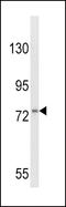 Colony Stimulating Factor 3 Receptor antibody, LS-C167082, Lifespan Biosciences, Western Blot image 