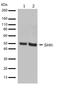 Sonic hedgehog protein antibody, 710410, Invitrogen Antibodies, Western Blot image 