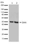 Sonic Hedgehog Signaling Molecule antibody, 710410, Invitrogen Antibodies, Western Blot image 