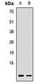 Ring-Box 1 antibody, LS-C668394, Lifespan Biosciences, Western Blot image 