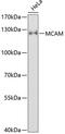 Melanoma Cell Adhesion Molecule antibody, 18-415, ProSci, Western Blot image 