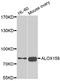 Arachidonate 15-Lipoxygenase Type B antibody, LS-C346124, Lifespan Biosciences, Western Blot image 
