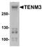 Teneurin Transmembrane Protein 3 antibody, A10047, Boster Biological Technology, Western Blot image 