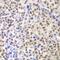 LIM Homeobox 4 antibody, GTX65966, GeneTex, Immunohistochemistry paraffin image 