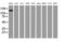 Protein Tyrosine Kinase 7 (Inactive) antibody, MA5-25774, Invitrogen Antibodies, Western Blot image 