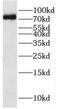 HPS1 Biogenesis Of Lysosomal Organelles Complex 3 Subunit 1 antibody, FNab03998, FineTest, Western Blot image 