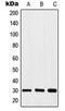 Homeobox A11 antibody, MBS820585, MyBioSource, Western Blot image 