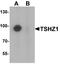 Teashirt Zinc Finger Homeobox 1 antibody, A08315, Boster Biological Technology, Western Blot image 