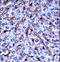 Dual Specificity Tyrosine Phosphorylation Regulated Kinase 2 antibody, LS-C164366, Lifespan Biosciences, Immunohistochemistry frozen image 
