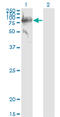 C1 esterase inhibitor antibody, LS-B6012, Lifespan Biosciences, Western Blot image 