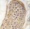 RPTOR Independent Companion Of MTOR Complex 2 antibody, LS-C100813, Lifespan Biosciences, Immunohistochemistry paraffin image 