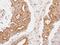 Cyclin D1 Binding Protein 1 antibody, NBP2-15762, Novus Biologicals, Immunohistochemistry frozen image 