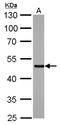 SMAD Family Member 5 antibody, NBP2-20413, Novus Biologicals, Western Blot image 