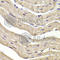 COP9 Signalosome Subunit 3 antibody, A7017, ABclonal Technology, Immunohistochemistry paraffin image 