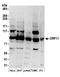 Oxysterol Binding Protein Like 11 antibody, A304-580A, Bethyl Labs, Western Blot image 