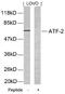 Activating Transcription Factor 2 antibody, 79-277, ProSci, Western Blot image 