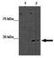 Methyl-CpG Binding Domain Protein 2 antibody, GTX82965, GeneTex, Western Blot image 