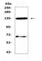 Fms Related Tyrosine Kinase 3 antibody, A00188-3, Boster Biological Technology, Western Blot image 