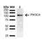 Phosphatidylinositol-4,5-Bisphosphate 3-Kinase Catalytic Subunit Alpha antibody, SPC-741D-FITC, StressMarq, Western Blot image 