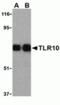 Toll Like Receptor 10 antibody, TA306157, Origene, Western Blot image 